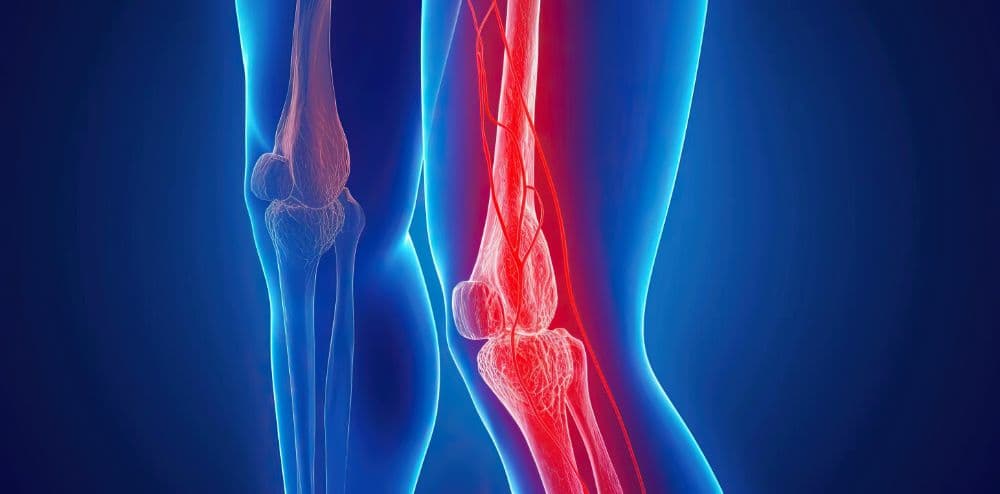 Un patient qui entre dans un scanner Newton